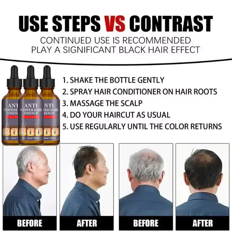 White hair killer, remove gray hair and restore natural hair color in 7 days thumbnail 6