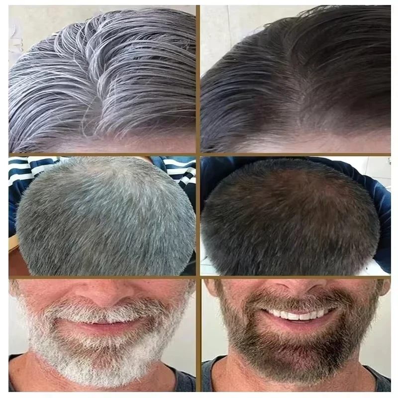 White hair killer, remove gray hair and restore natural hair color in 7 days thumbnail 2