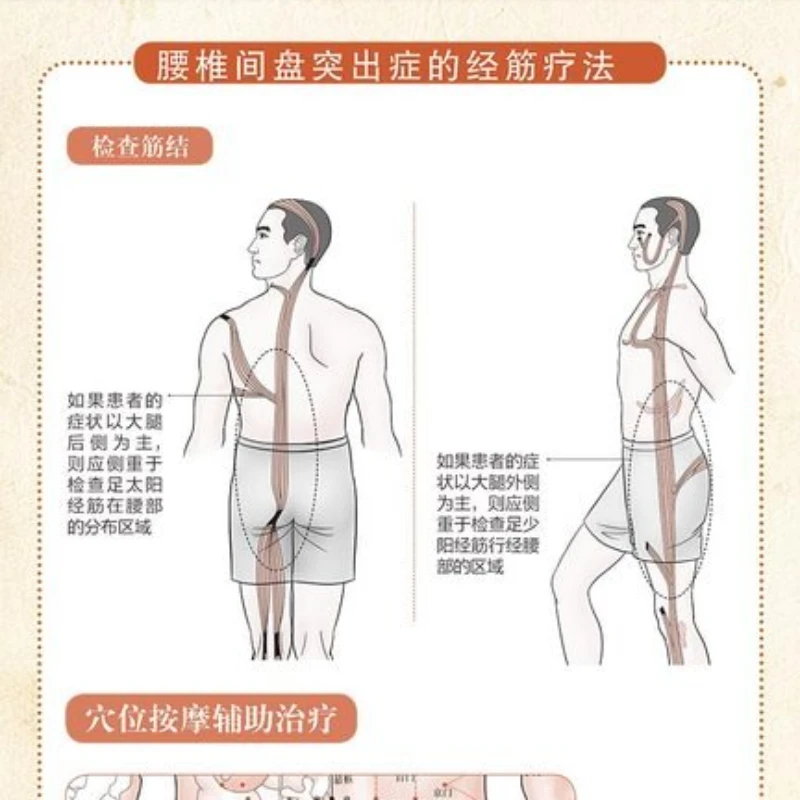 Illustrated Twelve Meridians Tendon Regulation Atlas Series Recipes, Acupuncture and Moxibustion Massage Health Book thumbnail 5