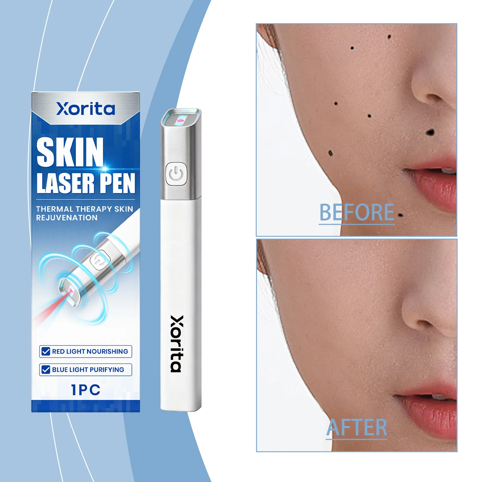 Laser Plasma Pen Skin Tag Remover Tool Black DotsFreckles Wart Remover Papilloma Pimples Skin Pigment Removal Beauty Device thumbnail 4