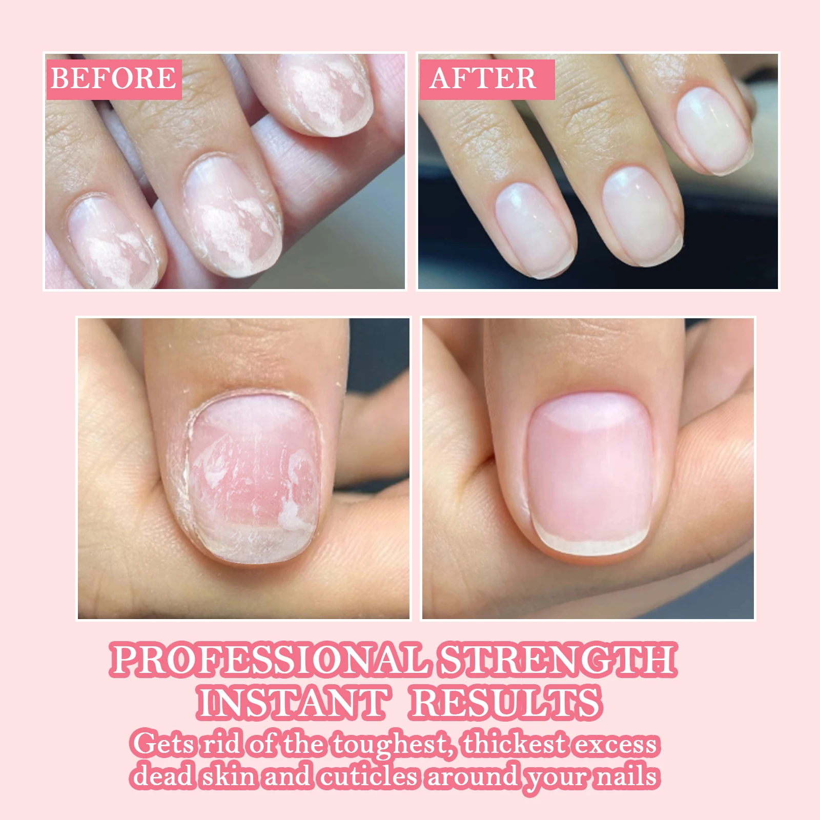 20ml Strong Nail Strengthener Calcium Protein Formula Strong Nails Hardener Protect Soft Thin Nails High Quality Repair Suppli thumbnail 3