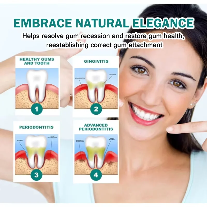 Rapid Repair Gums Serum Effectively Relieve Tooth Allergy Dental Caries Tooth Cleaning Toothpaste Relieve Tooth Damage Drops thumbnail 4