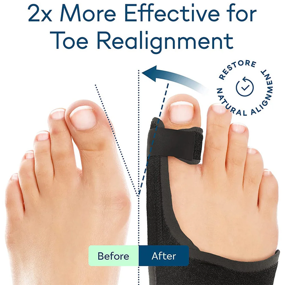 Toe Corrector Orthotics Bone Thumb Adjuster Hammer Protector Hallux Valgus Corrector Bunion Corrector Orthopedic Tool Care Tools thumbnail 3