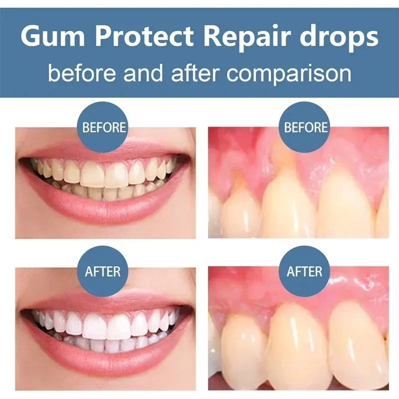 Rapid Repair Gums Serum Effectively Relieve Tooth Allergy Dental Caries Tooth Cleaning Toothpaste Relieve Tooth Damage Drops thumbnail 3