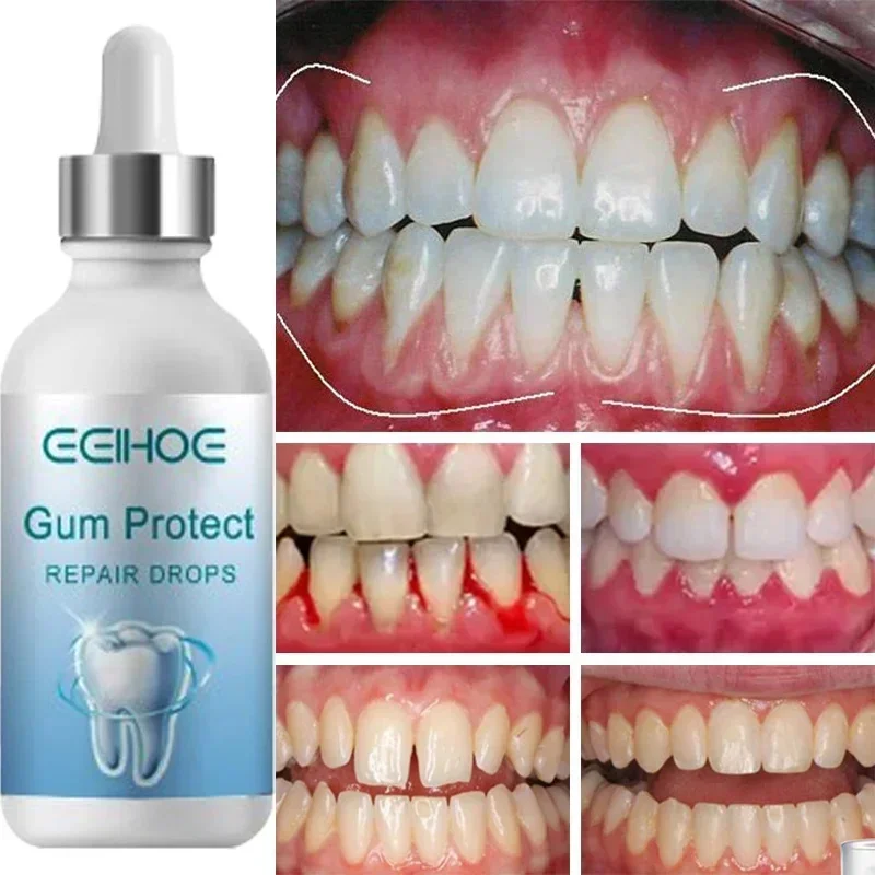 Rapid Repair Gums Serum Effectively Relieve Tooth Allergy Dental Caries Tooth Cleaning Toothpaste Relieve Tooth Damage Drops thumbnail 2