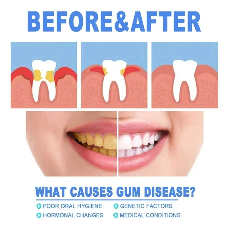 Rapid Repair Gums Serum Effectively Relieve Tooth Allergy Dental Caries Tooth Cleaning Toothpaste Relieve Tooth Damage Drops thumbnail 4