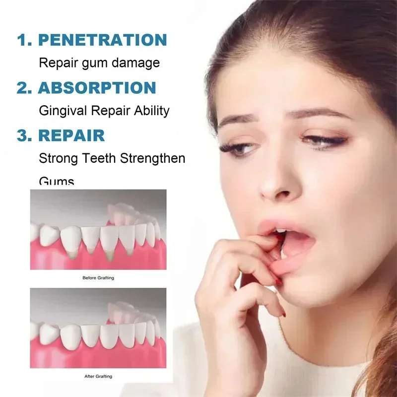 Rapid Repair Gums Serum Effectively Relieve Tooth Allergy Dental Caries Tooth Cleaning Toothpaste Relieve Tooth Damage Drops thumbnail 5