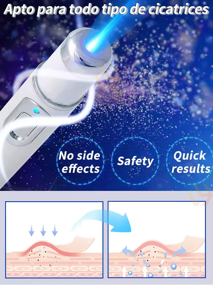 Scar removal laser product. Effective for all scars.hot thumbnail 3