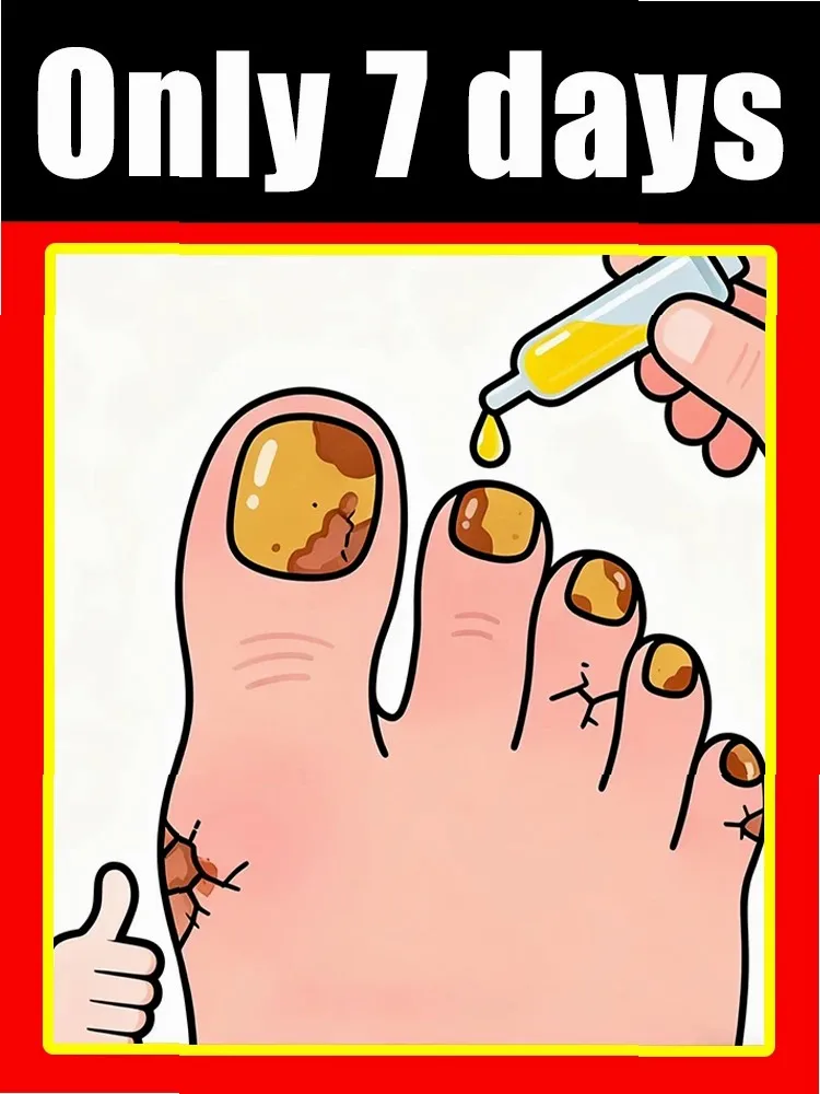 2025 Toenail Fungus Patch Waterproof Nail Repair Patches Nail Ingrown Correction Sticker Discolored Damaged Nail Foot Care Tool thumbnail 2