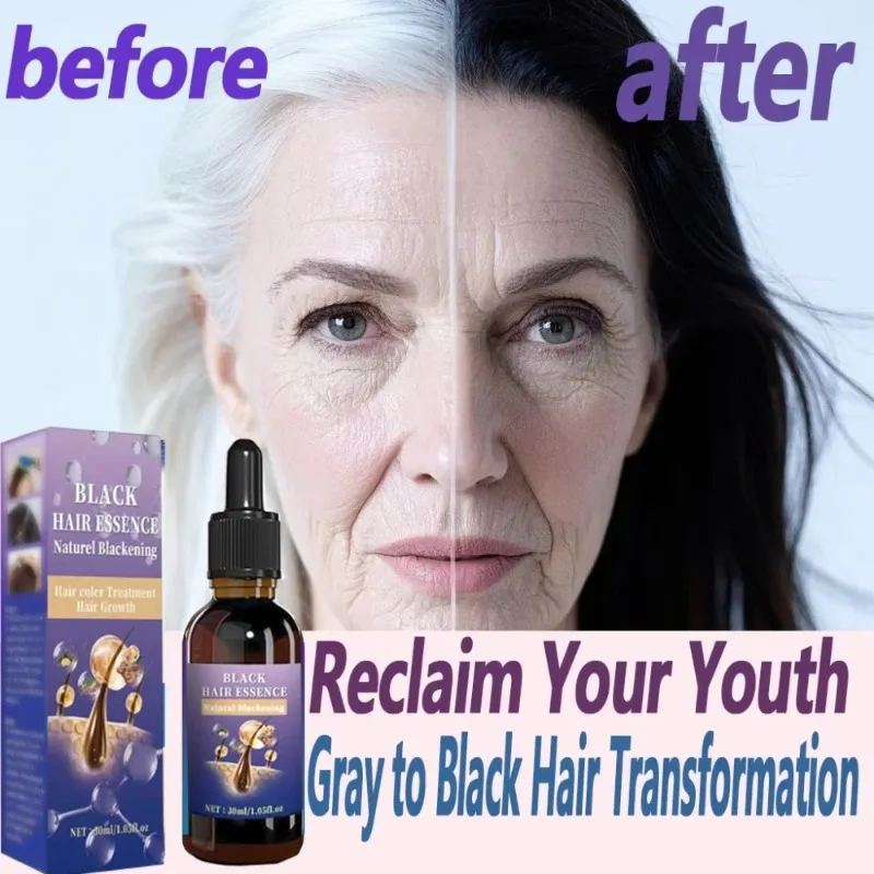 Scalp Care Black Essence Nourishes Hair Balances Oil Unclogs Follicles Boosts Shine thumbnail 2