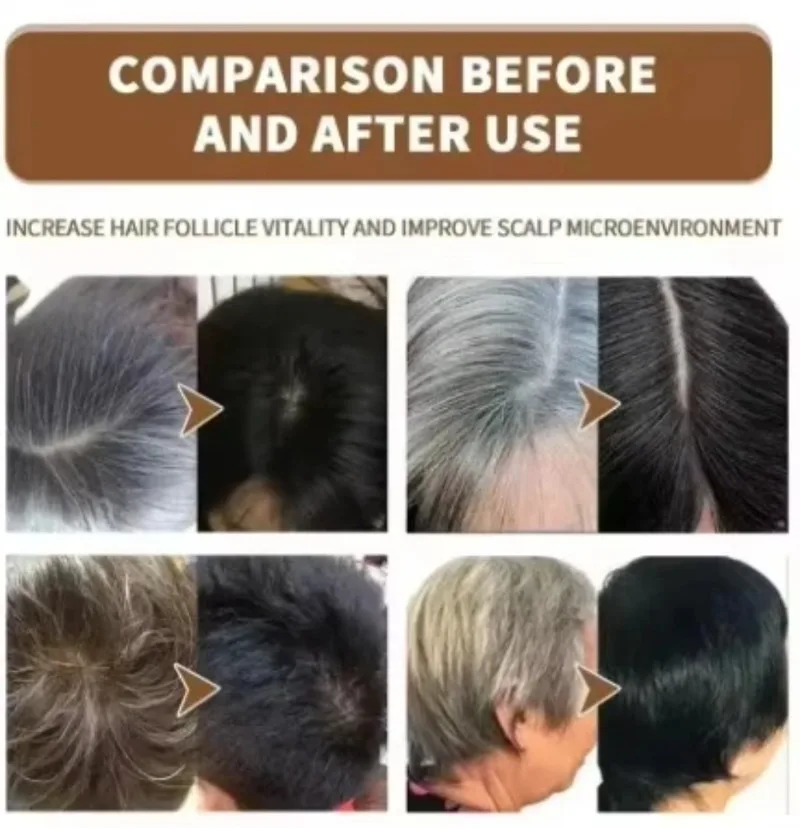 Scalp Care Black Essence Nourishes Hair Balances Oil Unclogs Follicles Boosts Shine thumbnail 5