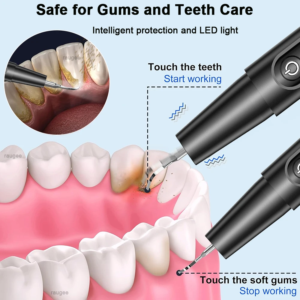 Electric Dental Calculus Remover Portable Teeth Tartar Eliminator Ultrasonic Plaque Cleaner Rechargeable Teeth Cleaning Scaler thumbnail 4