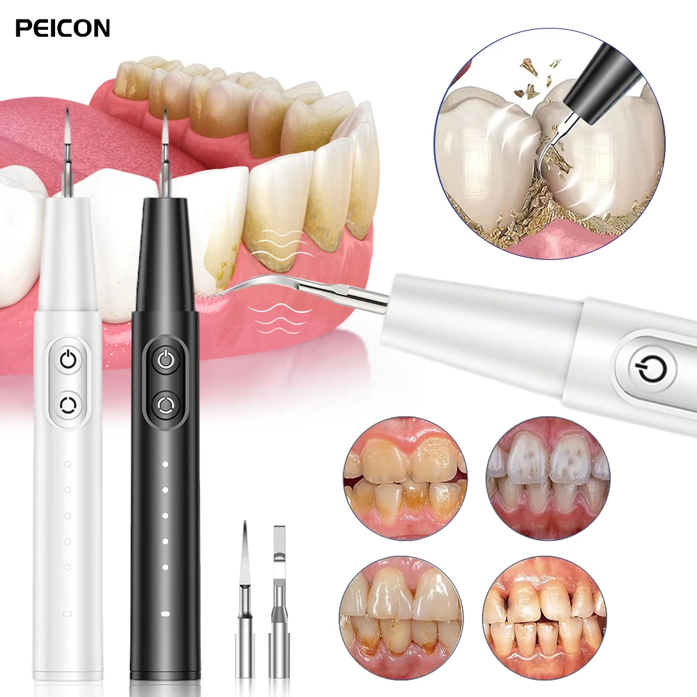 Electric Dental Calculus Remover Portable Teeth Tartar Eliminator Ultrasonic Plaque Cleaner Rechargeable Teeth Cleaning Scaler