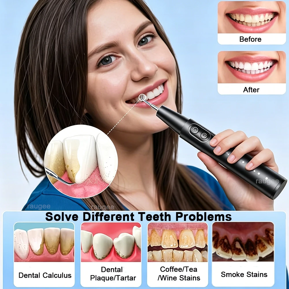 Electric Dental Calculus Remover Portable Teeth Tartar Eliminator Ultrasonic Plaque Cleaner Rechargeable Teeth Cleaning Scaler thumbnail 2