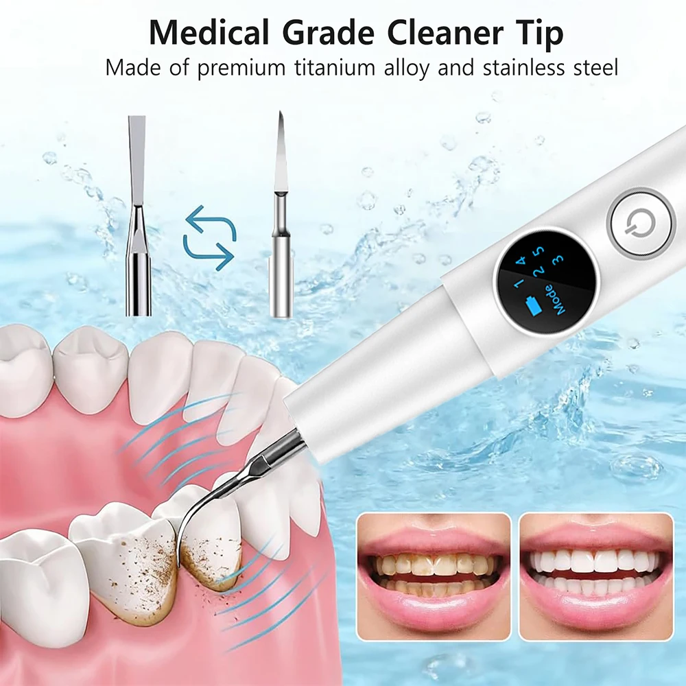 Dental Calculus Remover Ultrasonic Tooth Cleaner Tartar Eliminator Dental Ultrasound Plaque Stains Removal Teeth Whitening thumbnail 4
