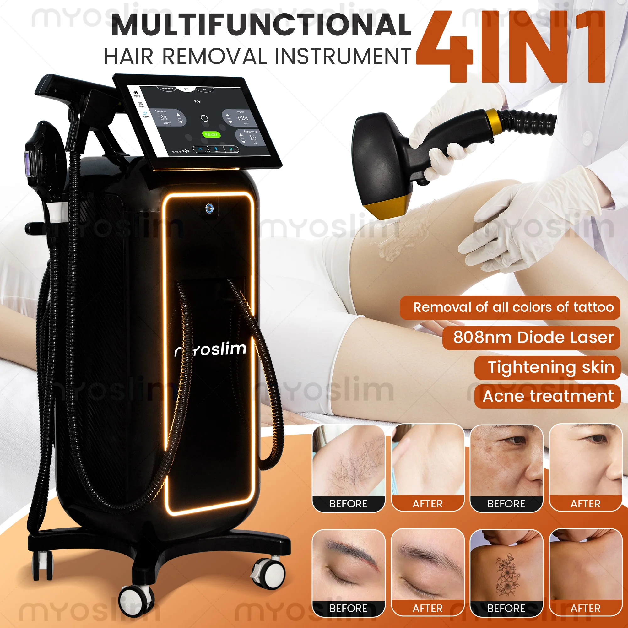 5000W Soprano 4in1 Titanium Ice Platinum Diode Laser Hair Removal Machine 755/808/940/1064nm Painless 4 Wavelengths thumbnail 3