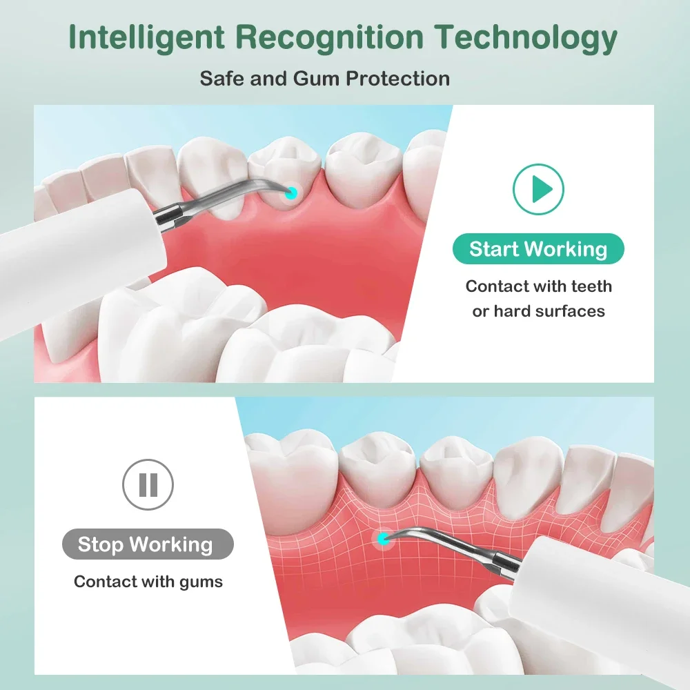 Home Ultrasonic Teeth Cleaner 5 Mode 9-Speed Adjustable 5 Color LED Light Gum Protection 37KHZ Vibration Dental Calculus Remover thumbnail 2