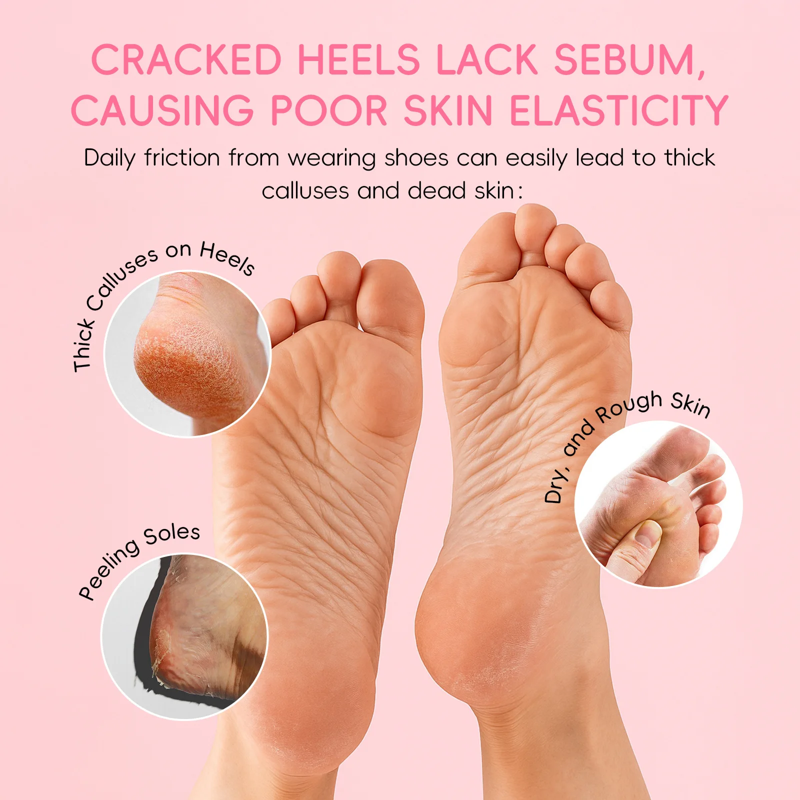 Foot Repair Stick 40g Callus Remover Deep Moisturizing for Cracked Heels Dry Dead Skin Removal Softens Rough Feet Home Care thumbnail 2