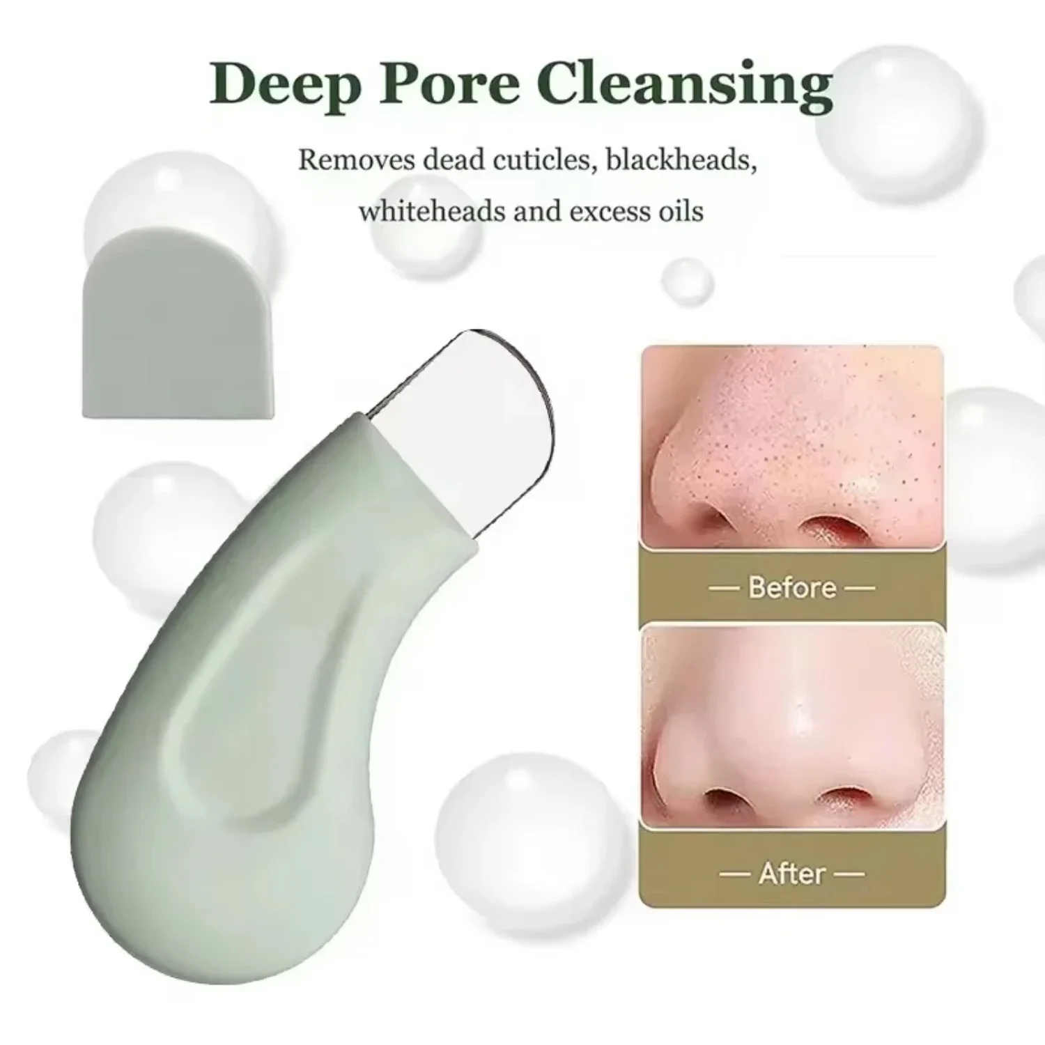Deep Cleansing Blackhead & Whitehead Removal Tool for Nose and Face - Skin Pore Cleaner Skin Care Beauty Tools Hot Sale thumbnail 2