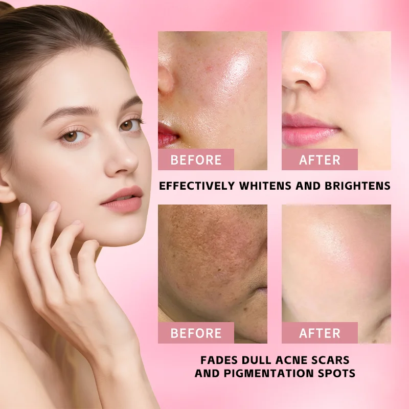 Collagen Skin Care Set Nicotinamide 5 Pcs Skin Texture Firmness Fast-Absorbing Nourishing For All Skin Type Korean Skincare Set thumbnail 5