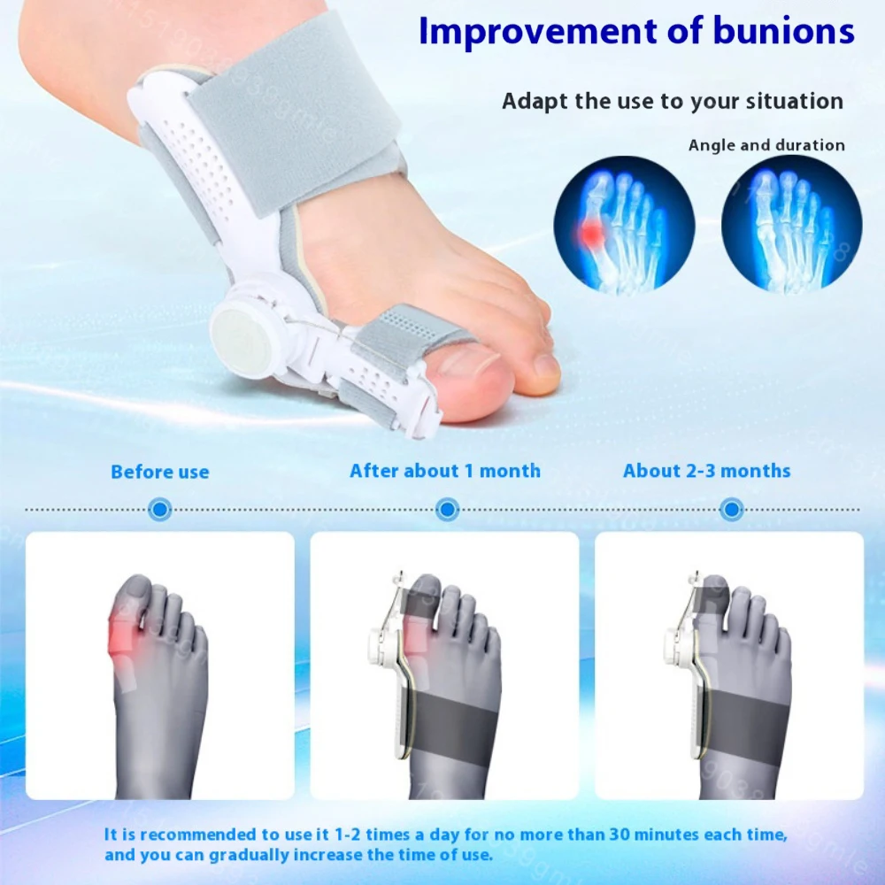 Bunion Corrector Foot Hallux Valgus Braces Rotatable Toe Separator Straightener Adjustable Pedicure Finger Toe Corrector Unisex thumbnail 2