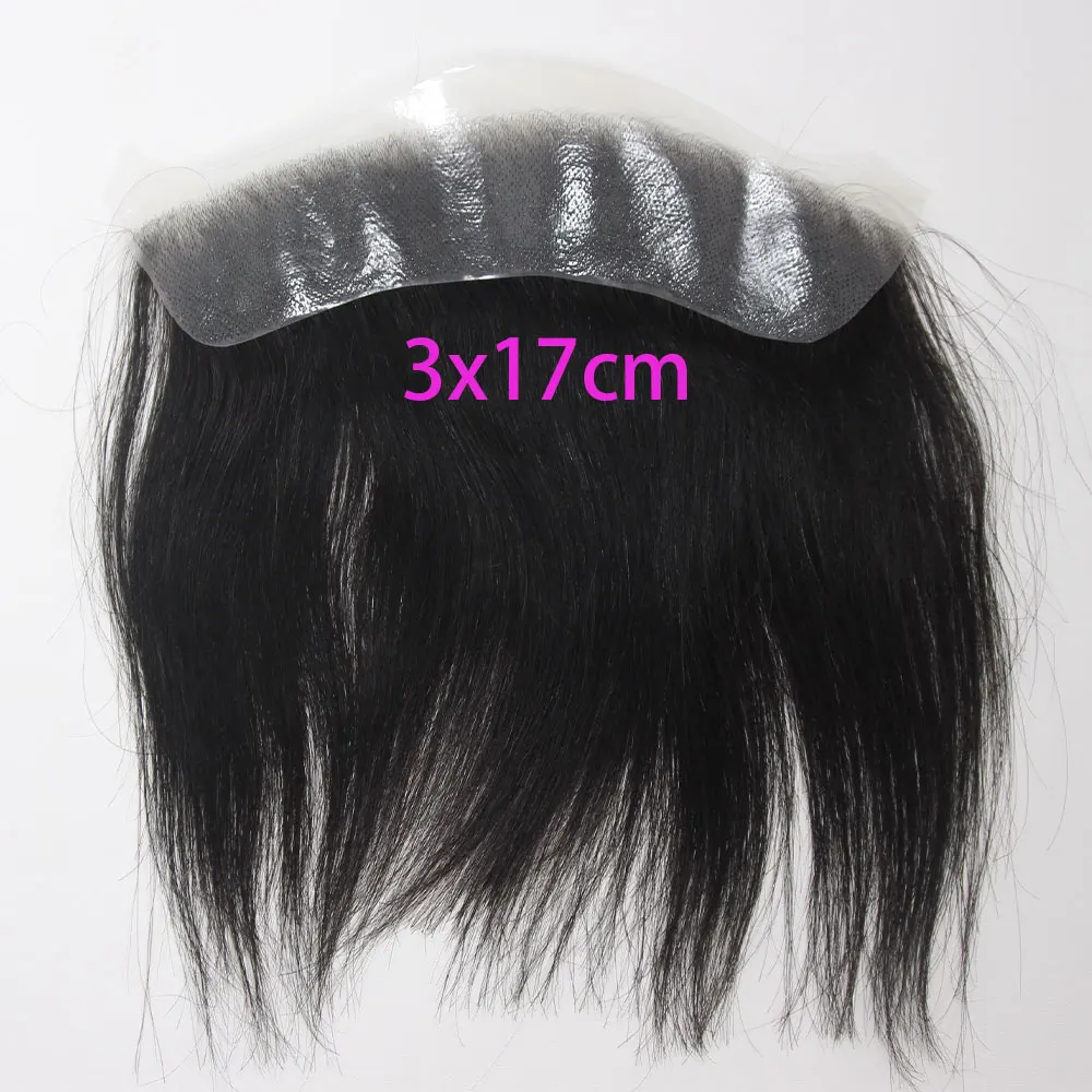 3cmX17cm