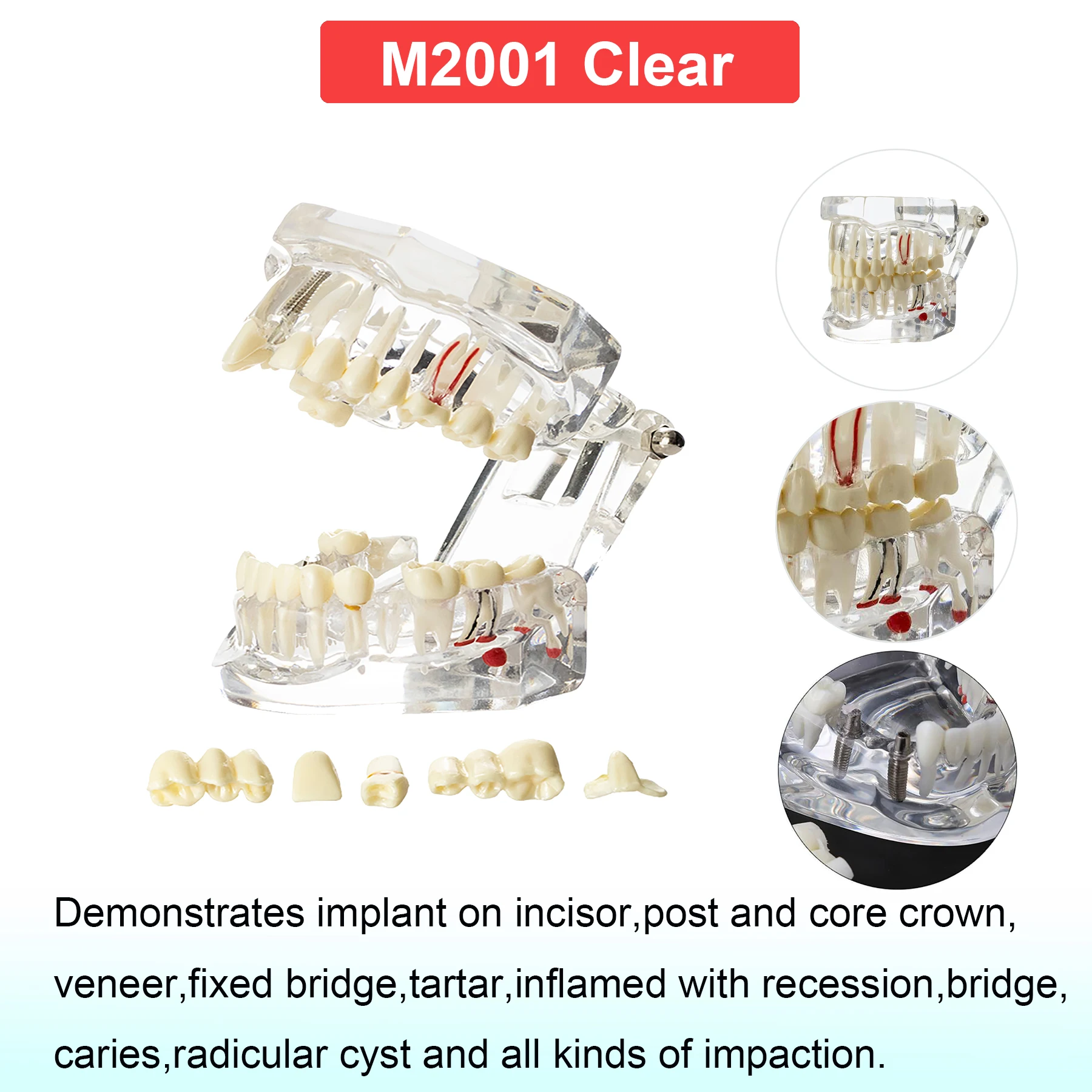 M2001 Clear