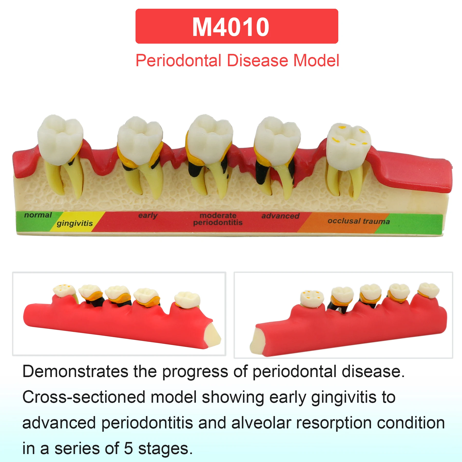 M4010