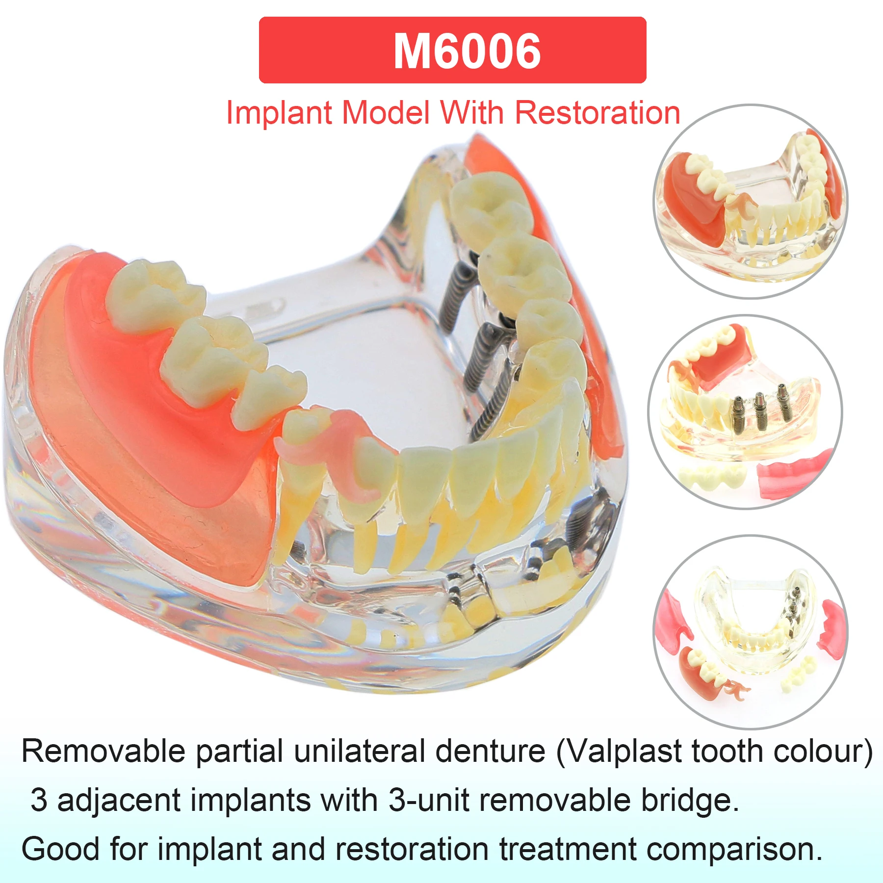 M6006
