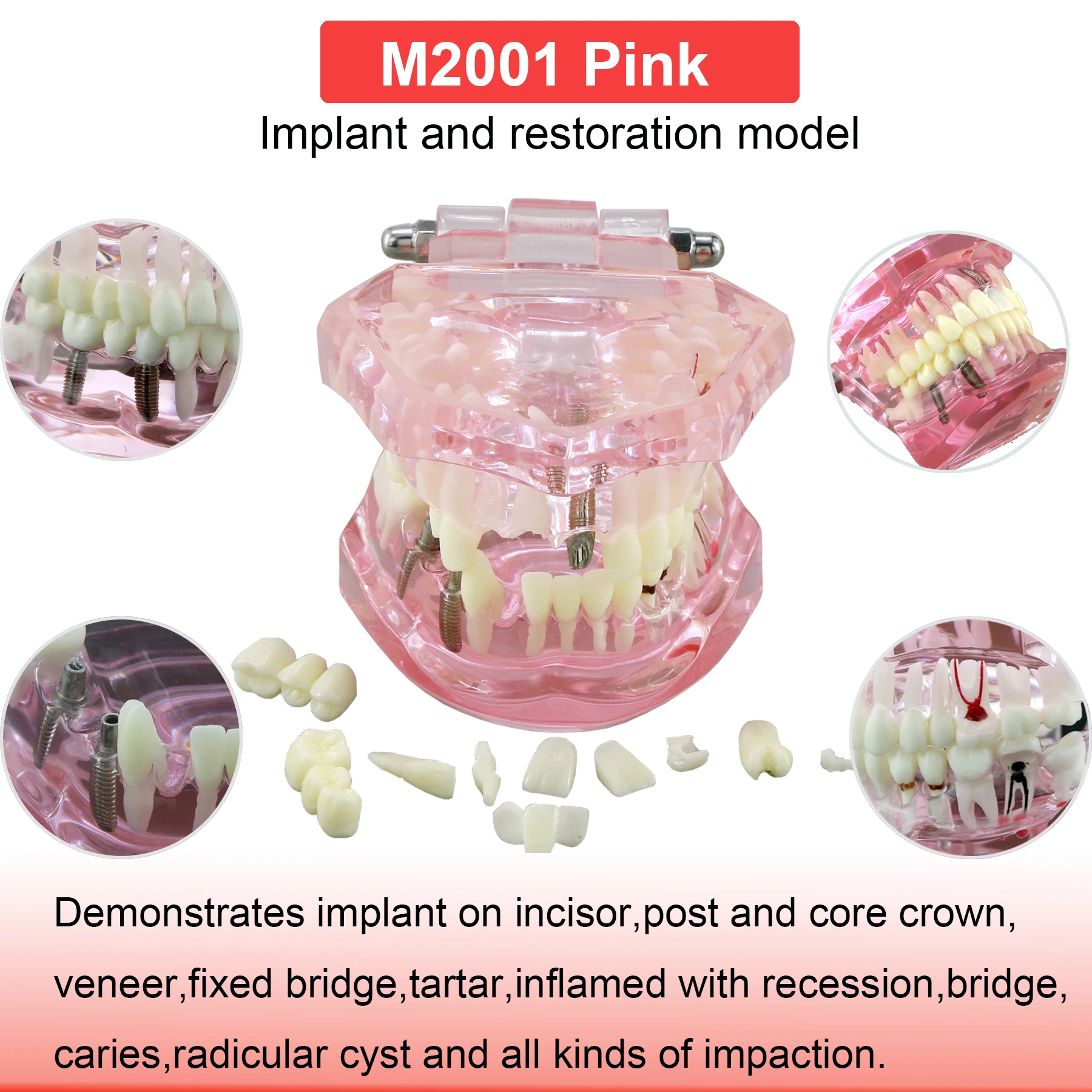 M2001 Pink