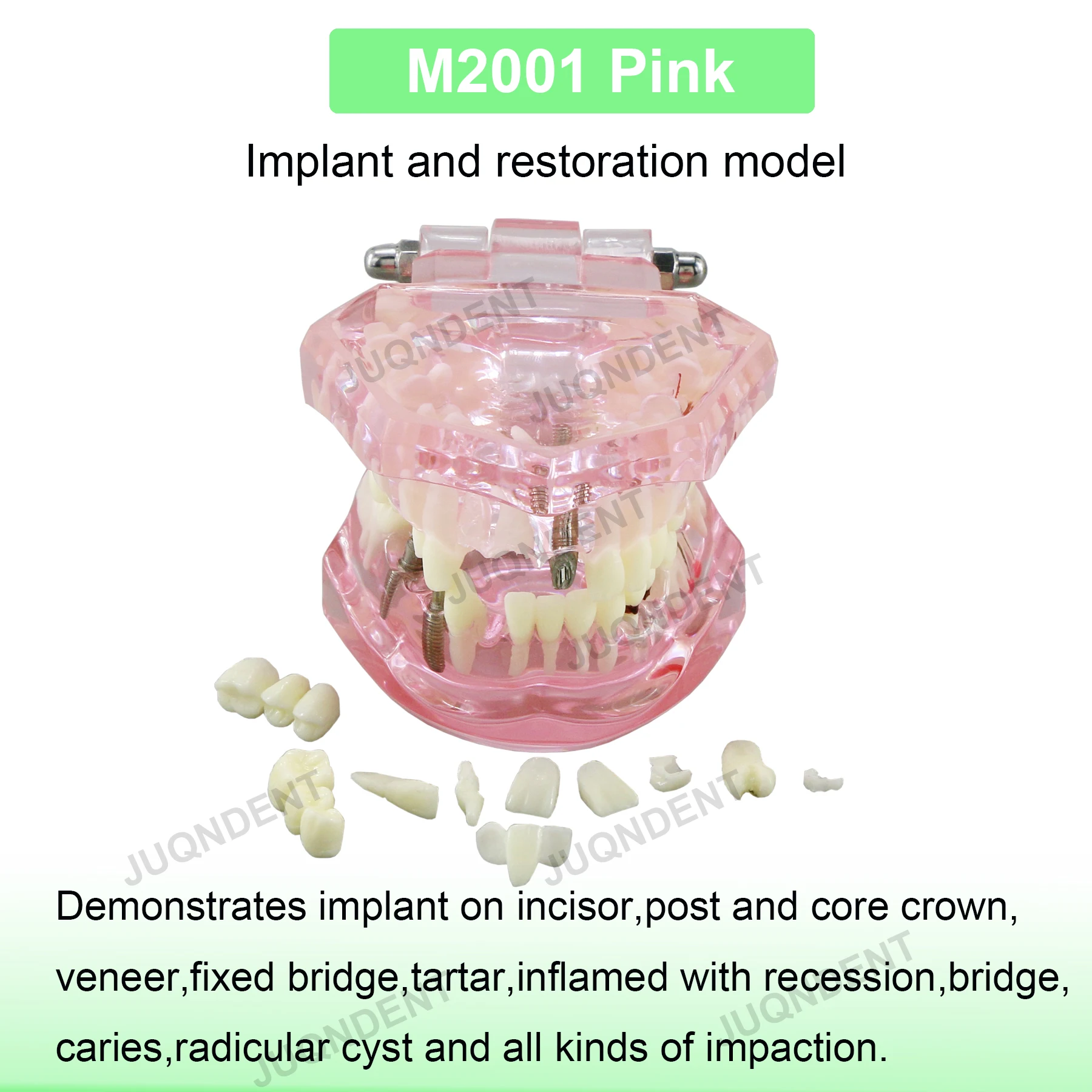 M2001 P