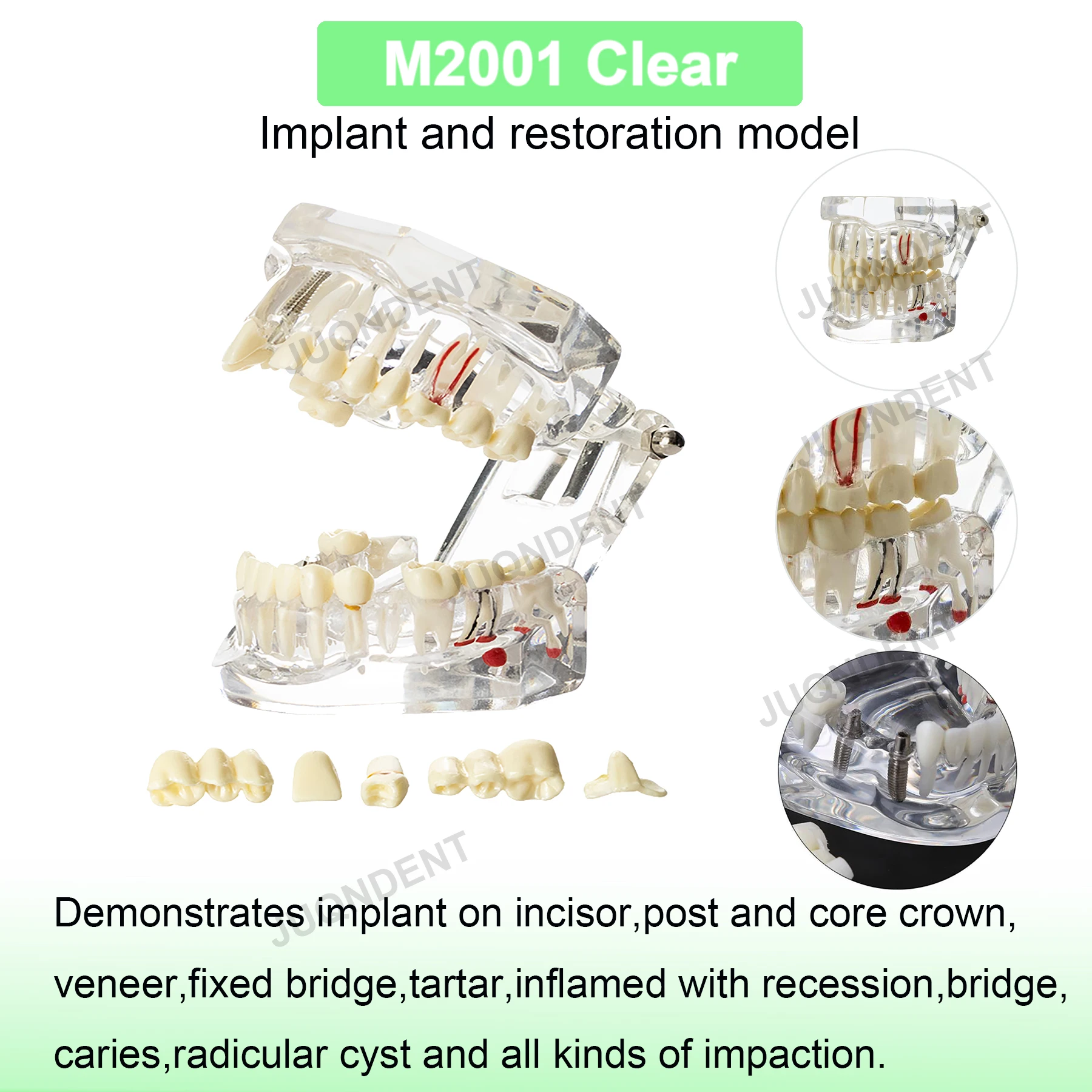 M2001 C