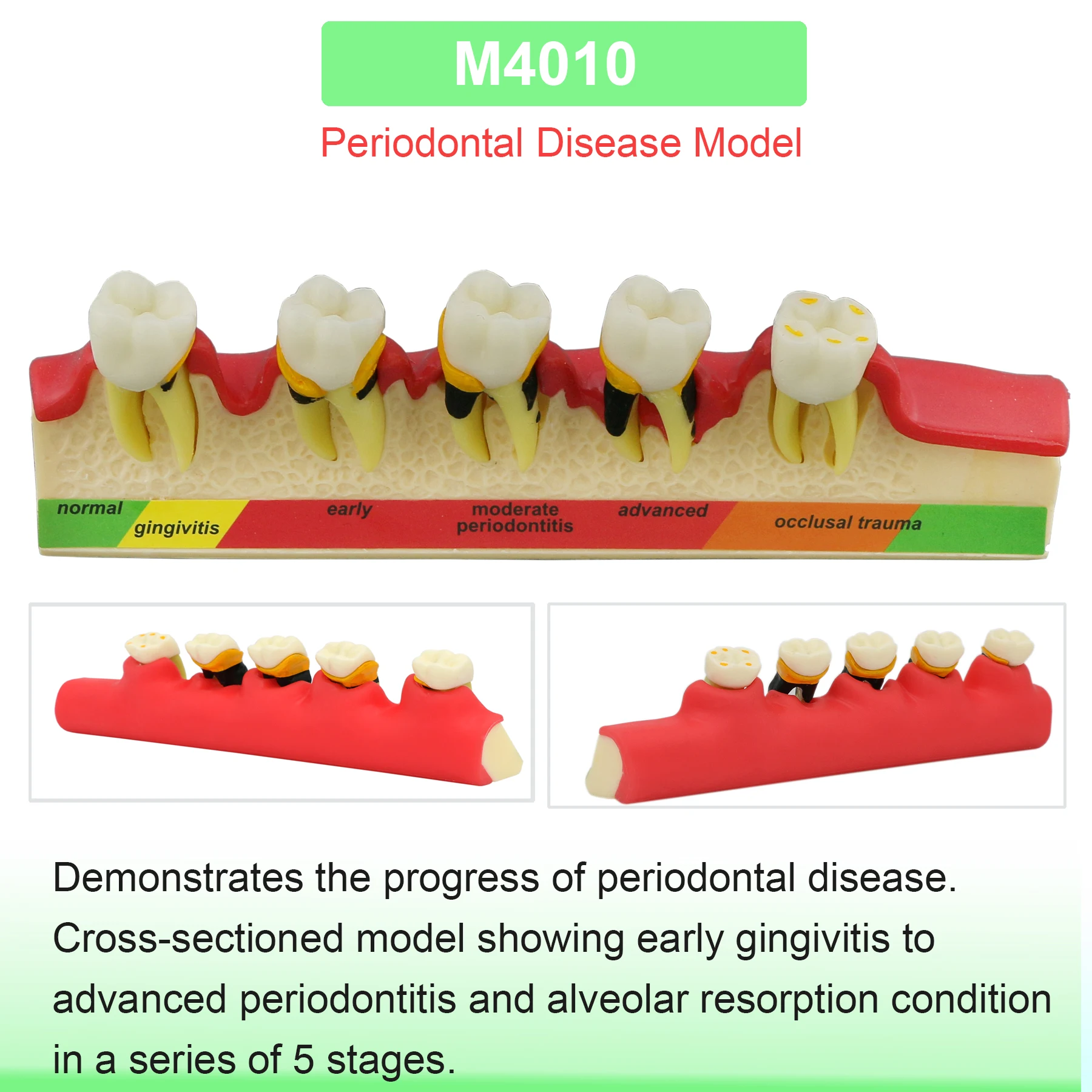 M4010