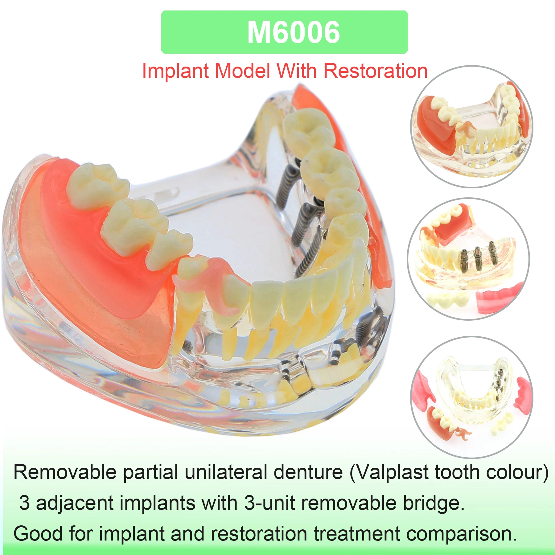 M6006