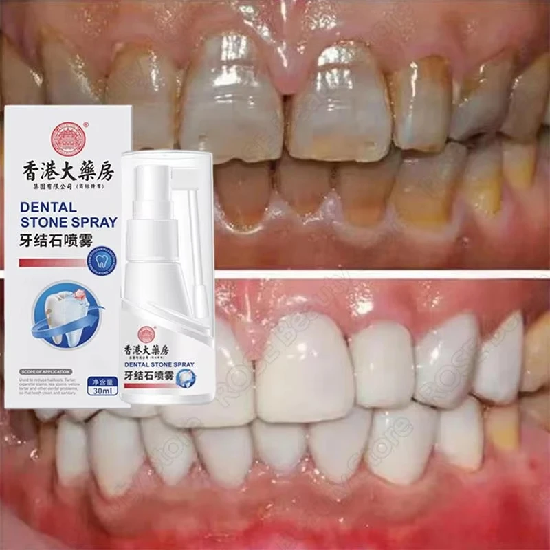 30ml