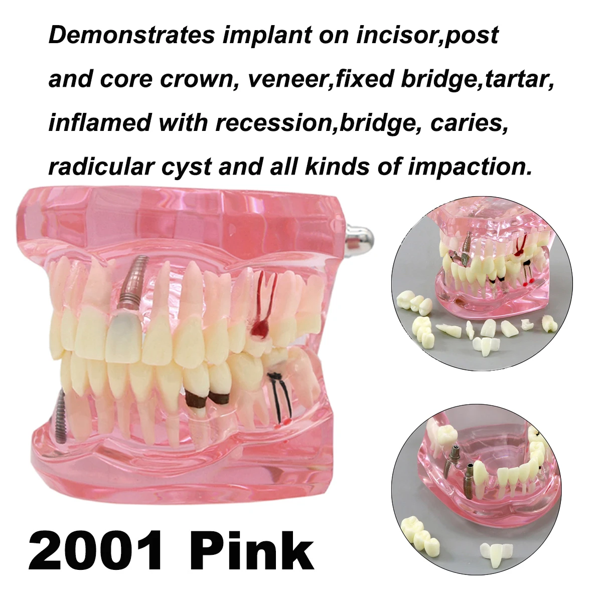 M2001 Pink