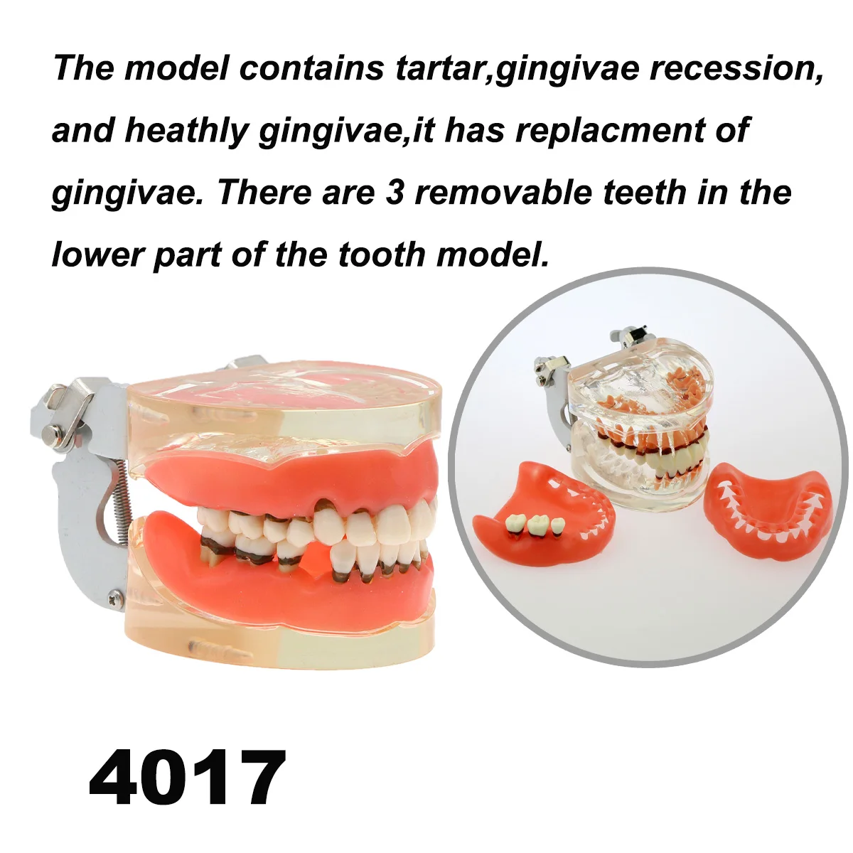 M4017