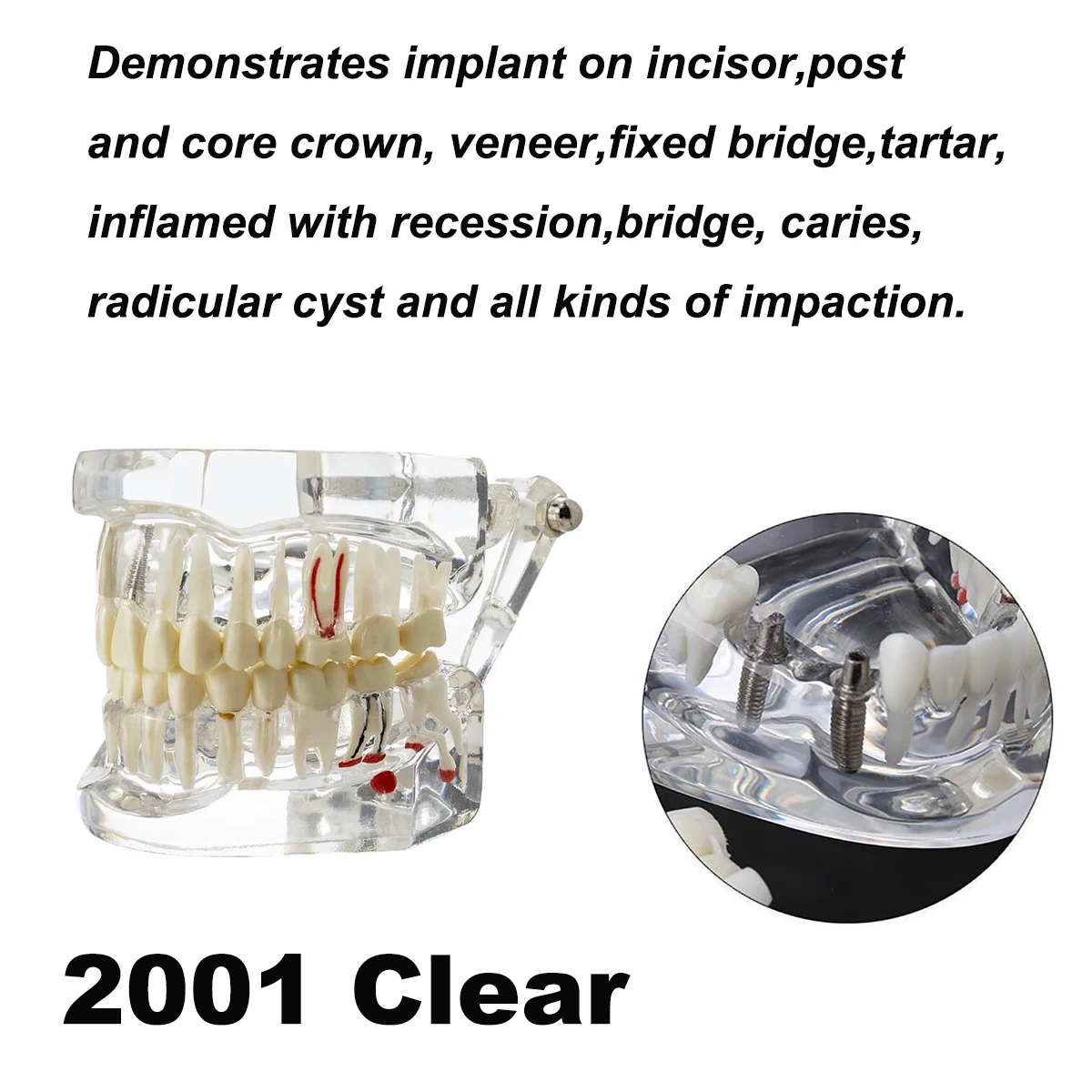 M2001 Clear